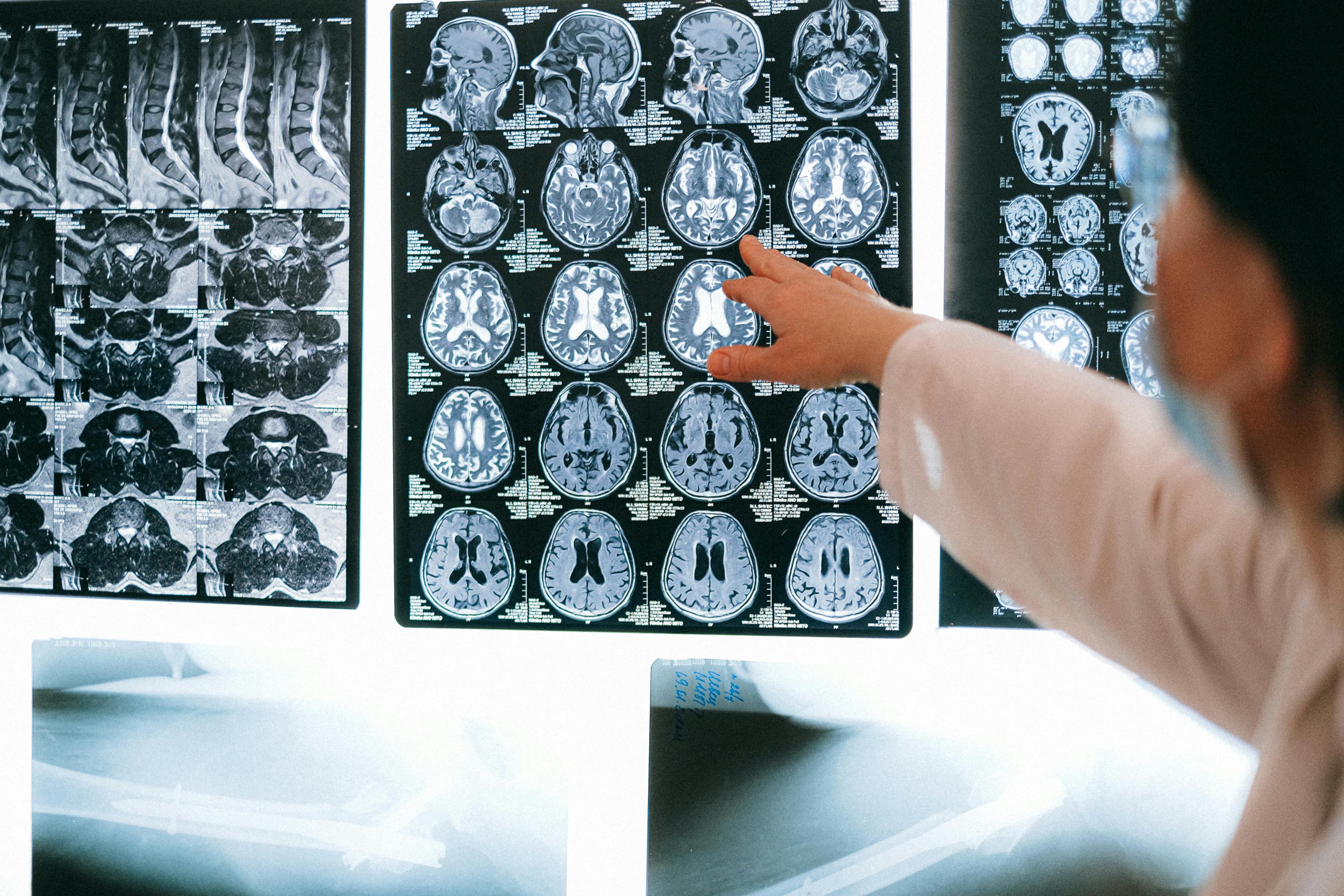 The Sleep-Cognition Connection: A Guide to Protecting Your Brain Health After 50